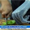 Video: Chef With Bionic Hand Cooks Better Than You Do